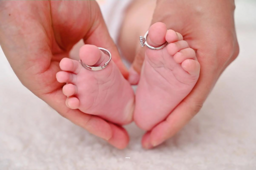 府谷孕妇怎样预防妊娠纹